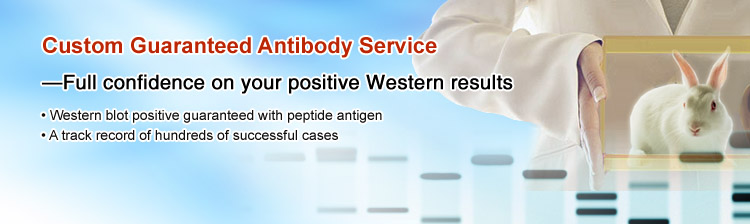 Custom Guaranteed Antibody Service