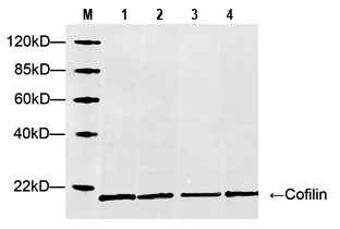 Western blot results 