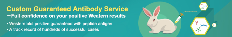 Custom Guaranteed Antibody Service Custom Guaranteed Antibody Service