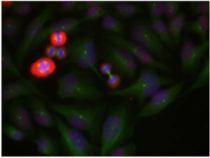 Phospho Specific Antibodies