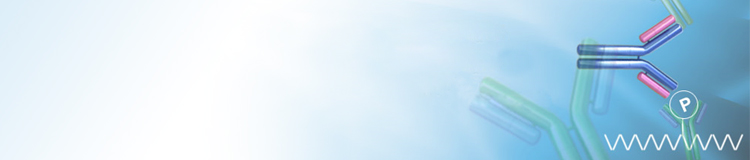 Protein phosphorylation-specific antibody services Protein phosphorylation-specific antibody services