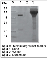 Proteinreinigung Resin