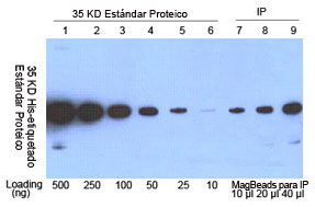purificación de proteína His-etiquetada por Anti-His mAb MagBeads