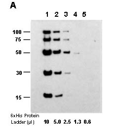 Examples of using ONE-HOUR Western<sup>TM</sup> Blot Kit