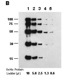 Examples of using ONE-HOUR Western<sup>TM</sup> Blot Kit