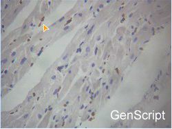 Detecting apoptosis induced group using GenScript TUNEL Apoptosis Detection Kit