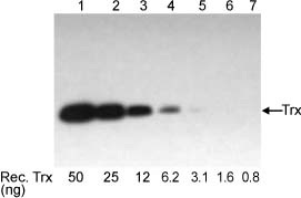 Western blot with One-Step Trx-Tag Western Kit