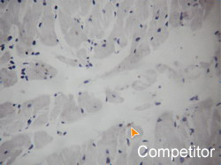 Detecting negative control group using competitor's Apoptosis Detection Kit