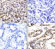 Tissue Array