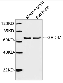 Rabbit Anti-GAD67 Polyclonal Antibody