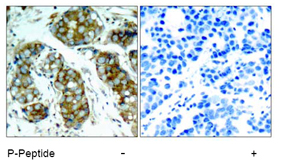 Rabbit Anti cdc25A (Phospho-Ser76) pAb IHC