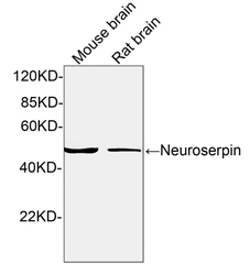 Rabbit Anti-Neuroserpin Polyclonal Antibody