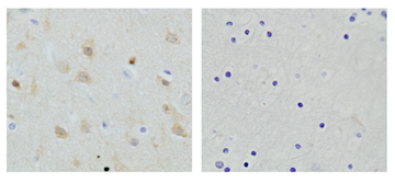 Rabbit Anti-NSE Polyclonal Antibody