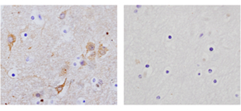 Rabbit Anti-NSE Polyclonal Antibody
