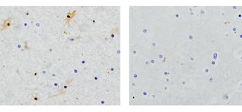 Rabbit Anti-NSE Polyclonal Antibody