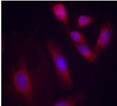 Rabbit Anti NF-κB p65 (Phospho-Ser536) (polyclonal) Immunofluorescence analysis