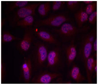 Rabbit Anti Myc (Phospho-Thr358) (polyclonal) Immunofluorescence analysis Rabbit Anti Myc (Phospho-Thr358) (polyclonal) Immunofluorescence analysis