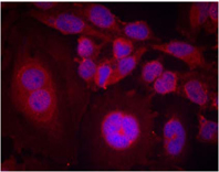 Rabbit Anti STAT3 (Phospho-Ser727) (polyclonal) Immunofluorescence analysis