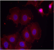 Rabbit Anti HER2 (Phospho-Tyr877) (polyclonal) Immunofluorescence analysis