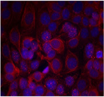 Rabbit Anti HER2 (Phospho-Tyr1221, 1222) (polyclonal) Immunofluorescence analysis