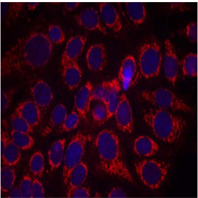 Rabbit Anti HER2 (Phospho-Tyr1248) (polyclonal) Immunofluorescence analysis