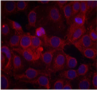 Rabbit Anti VEGFR2 (Phospho-Tyr1175) (polyclonal) Immunofluorescence analysis