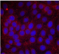 Rabbit Anti VEGFR2 (Phospho-Tyr1214) (polyclonal) Immunofluorescence analysis