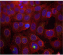 Rabbit Anti-VEGFR2 (Phospho-Tyr951) Polyclonal Antibody Immunofluorescence Analysis Rabbit Anti-VEGFR2 (Phospho-Tyr951) Polyclonal Antibody Immunofluorescence Analysis