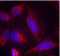 Rabbit Anti IGF-1R (Phospho-Tyr1161) (polyclonal) Immunofluorescence analysis Rabbit Anti IGF-1R (Phospho-Tyr1161) (polyclonal) Immunofluorescence analysis