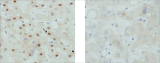 Rabbit Anti-Ki-67 Polyclonal Antibody