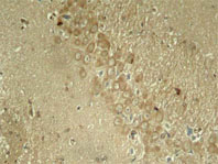 Immunohistochemical analysis using anti Tau Phospho-Ser 262