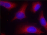 Immunofluorescence analysis using anti Tau Phospho-Ser 262