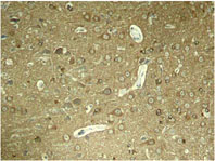 Rabbit Anti Tau (Phospho-Ser404) pAb Immunohistochemical analysis