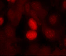 Rabbit Anti FKHR (Phospho-Ser256) (polyclonal) Immunofluorescence analysis