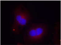 Rabbit Anti FAK (Phospho-Tyr925) (polyclonal) Immunofluorescence analysis