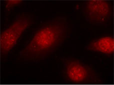 Rabbit Anti Rb(Phospho-Ser780) (polyclonal) Immunofluorescence analysis