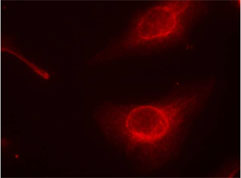 Rabbit Anti cofilin (Phospho-Ser3) (polyclonal) Immunofluorescence analysis Rabbit Anti cofilin (Phospho-Ser3) (polyclonal) Immunofluorescence analysis