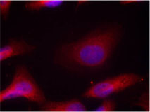 Rabbit Anti Src (Phospho-Tyr529) (polyclonal) Immunofluorescence analysis Rabbit Anti Src (Phospho-Tyr529) (polyclonal) Immunofluorescence analysis
