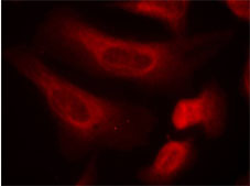 Rabbit Anti STAT1 (Phospho-Ser727) (polyclonal) Immunofluorescence analysis