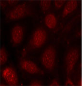 Immunofluorescence analysis using Rabbit Anti PKCβ (Phospho-Thr641)