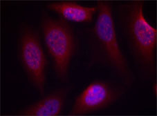 Immunofluorescence analysis using Rabbit Anti SEK1/MKK4 (Phospho-Ser80)
