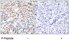 Rabbit Anti p27Kip1 (Phospho-Thr187) (polyclonal) Immunohistochemical analysis