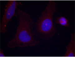 Immunofluorescence analysis using Rabbit Anti Pyk2 (Phospho-Tyr402)
