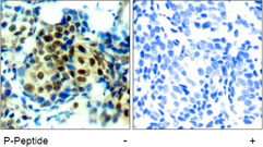 Rabbit Anti-p44/42 MAP Kinase (Phospho-Thr202) Polyclonal Antibody Immunohistochemical Analysis