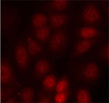 Immunofluorescence analysis using Rabbit Anti p70 S6 Kinase (Phospho-Thr421)