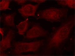 Rabbit anti-p56Dok-2(Phospho-Tyr299) pAb Immunofluorescence Analysis