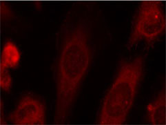 Rabbit Anti-eIF2α (Phospho-Ser51) Polyclonal Antibody IF