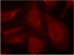 Immunofluorescence analysis using Rabbit Anti BIM (Phospho-Ser69)