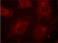 Immnofluorescence analysis using Rabbit Anti Gab1 (Phospho-Tyr627) Immnofluorescence analysis using Rabbit Anti Gab1 (Phospho-Tyr627)