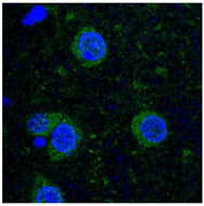 Immunofluorescence Analysis using GenScript Rabbit Anti-CaMKII (Phospho-Thr286) Polyclonal Antibody